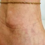 Αλυσίδα ποδιού